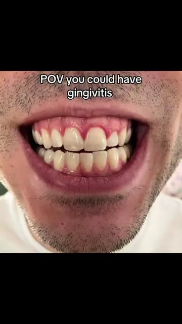 You could have it  