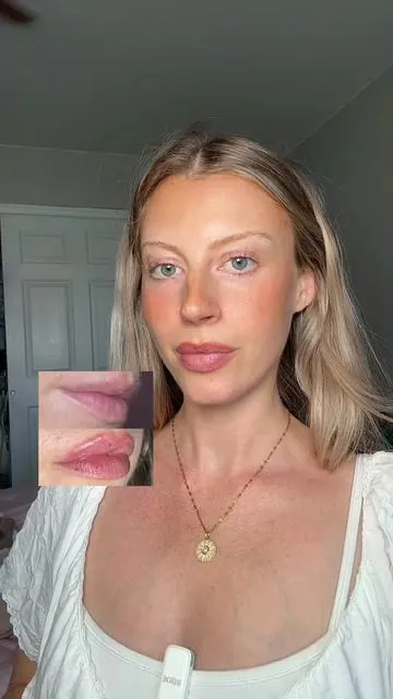 #volufiline #fillerinabottle 