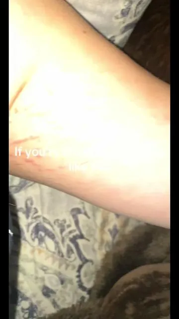 #skin #stretchmark #stretchmarks #beautyproduct #viral 