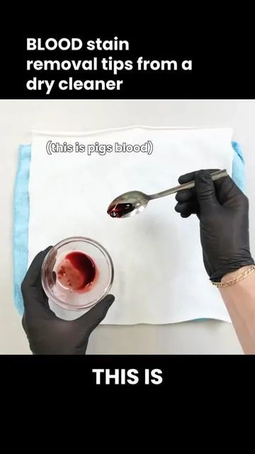 A dry cleaner's guide to removing blood stains. With the right approach rooted in science, even stubborn stains are manageable. Fresh Stain: Step 1 — Rinse the stain under cold running water to remove any large physical particles. Hot water will set a blood stain, so always use cold. Step 2 — Apply either hydrogen peroxide directly to the stain, or a stain remover spray that contains the enzyme protease. Let it sit for a full hour before washing. Hydrogen peroxide reacts with catalase in blood, producing oxygen gas that physically tears the stain apart. Protease-based sprays break down blood's protein molecules, making them easier for water to wash away. Step 3 — Use cold water and a good detergent. For extra effectiveness, add powdered oxygen bleach directly to the drum before loading — helpful but not required. Step 4 — Check the garment for any remaining stain before placing it in the tumble dryer. Heat will cook the stain in permanently. Old or Set Stain (for stains that are weeks old or have already been through the dryer, the steps are similar but require more time) Step 1 — Same starting point, flush thoroughly under cold water. Step 2 — Apply hydrogen peroxide or a protease-based stain remover and leave it to work longer than you would with a fresh stain. Hydrogen peroxide will not foam as dramatically on a set stain — that is normal. Step 3 — Wash on the appropriate cycle using cold water and a good detergent. Step 4 — If the stain remains, choose one of these methods Option A — Hydrogen peroxide and air dry: Spray the stain with hydrogen peroxide and leave to air dry indoors. This gradually corrects the color and may require a few rounds. Option B — Oxygen bleach soak (more effective): Fill a bucket or sink with hot water and add a powdered oxygen bleach product, using sodium percarbonate as the active ingredient. Soak overnight, then rewash. Repeat for severe stains. #Laundry #BloodStain #StainRemovalTips
