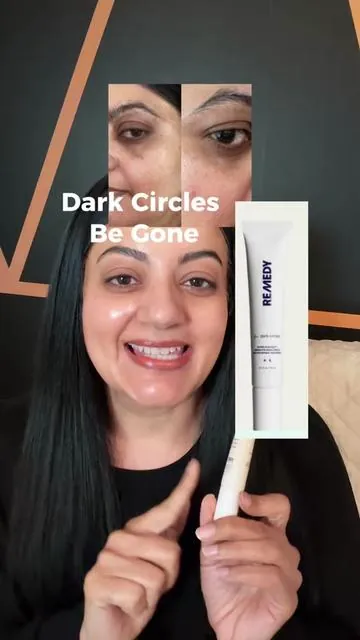 I told you the second this came back back I was buying it. Dark circles on brown skin are a pigmentation problem and this formula hits four pathways at once. Get it before it sells out again. @Remedy Science #hyperpigmentation #darkcircles #darkcirclesundereyes #eyecream #brownskin 