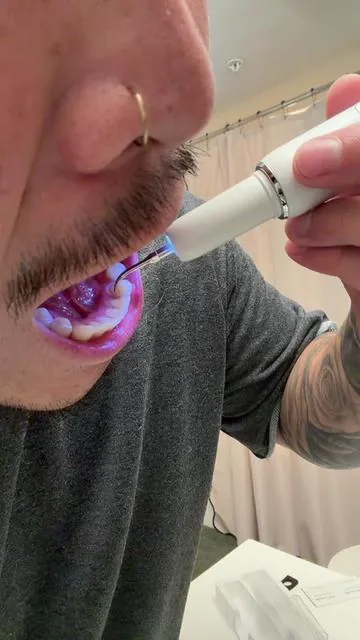 My teeth’s about to be super clean! #tiktokshopcreatorpicks #dealsforyoudays #SummerVibes #Dealsforyou 