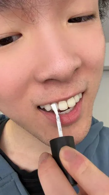 These blew my mind ngl!! #whiteteeth #drdent 