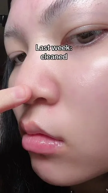 ILSO weekly reset routine 💕 #ilso #koreanskincare #blackhead #porecare #tiktokshop 