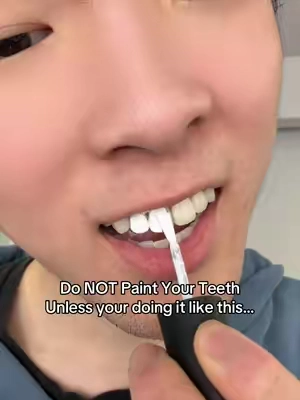 Ngl these had me shocked!! #whiteteeth #drdent 