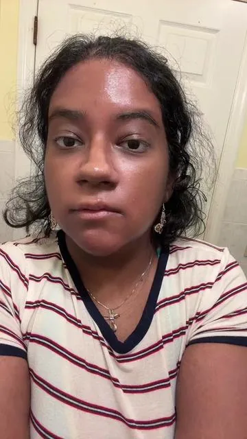 I deserve a Razzie for my performance 😂 but seriously get ILSO @kglowing_official @ilso_global ilso #gifted #sebumsoftener #blackhead #koreanskincare #badacting