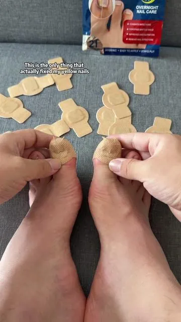 You won’t believe what one week of using this patch did to my feet!✨#nailfungus #nailrepair #uglynail #yellownails #DealsforYouDays 