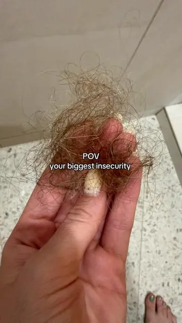 Hair growth takes patience and consistency. And even if you’re on the right products, it can still be a long journey. It’s no wonder the @LILYEVE GLOBAL hair and scalp serum was a top product at Olive Young in Korea last year. They also just launched at Ulta. BUT right now they are running a huge sale on TikTok shop, so it’s the perfect time to stock up so you have your new summer healthy hair routine. #hairgrowth #healthyhairjourney #scalphealth #hairlossjourney #DealsForYouDays 