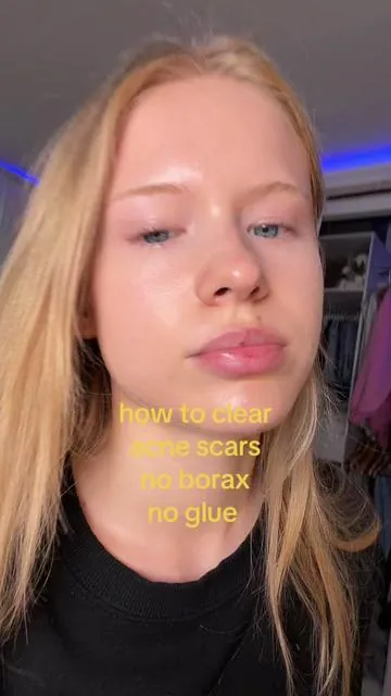 can finally leave the house bare faced 