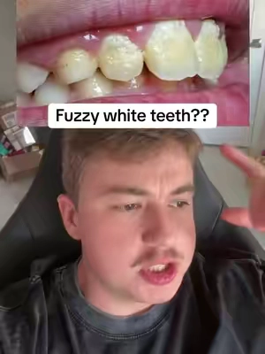 If u got this video it’s no mistake 😳 #teethsensitivity #gingivitis #dealsforyoudays #gurunanda @GuruNanda LLC @Puneet Nanda bridge the gap 