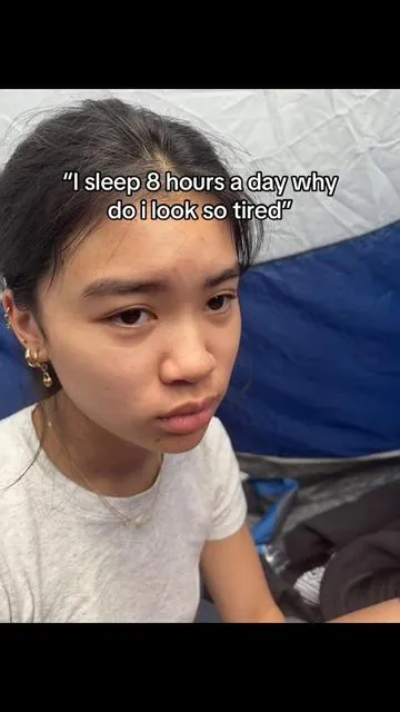 I’m so shocked with this ngl #eyebags #darkcircles 