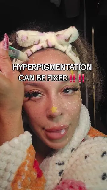 what they dont want us to know  #creatorsearchinsights #hyperpigmentation #darkspots #hyperpigmentationtreatment #fadedarkspots 