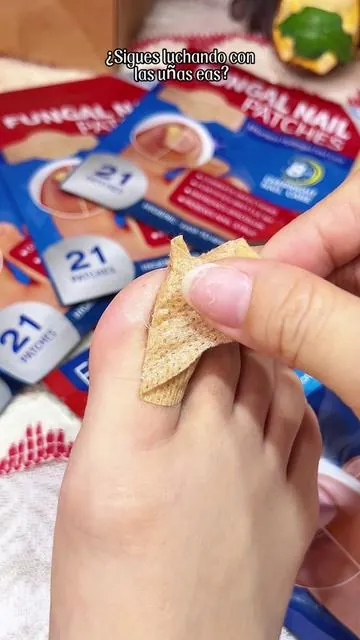 "Funky nails? Not anymore. These patches are SAVING toes 🔥👍#NailTok#FootCare#FungalNails#NailFix#BeforeAndAfter