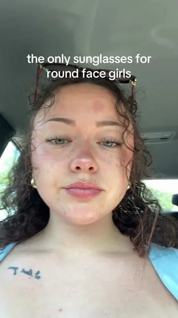 ft the bug bite on my forehead 😍😍😍😍😍😍  #ad #roundfacegirl #roundfaceshape #roundface #sunglassesforroundface 
