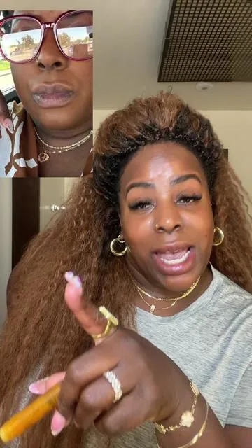 #darklips #hyperpigmentation #discoloration @✨ Glo Melanin ✨ 