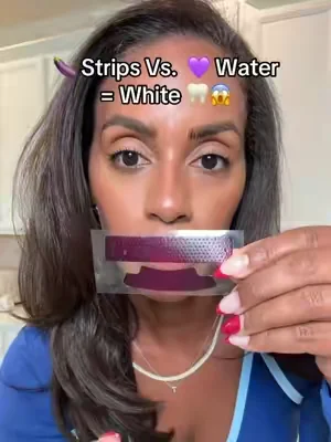 Who wins?? 😱 #whitesmile #yellowteeth #dealsforyoudays #summerwins 