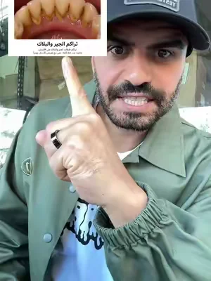 #tiktokshop #tiktokmademebuyit #تيك_توك_شوب #dealsforyoudays #تبييض_الاسنان 