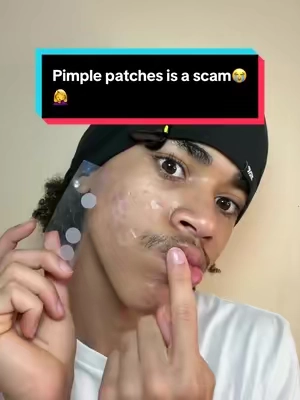 Actual gamechangerr#pimple #skincare #pimplepatches #dimora 