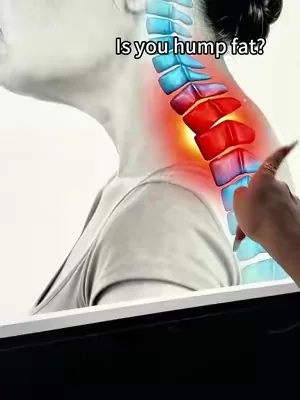POV: You've been slouching for 20 years… this $26posture bra fixed it in 3 days 😭 Grab it before the mid-year sale ends! #PostureBra #BackPainRelief #SummerWins #DealsforYouDays