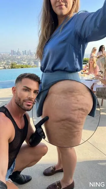 I frickn love this shit for my cellulite and stretch marks. #SummerVibes #cellulite #DealsforYouDays #SummerWins #WeeklyDeals