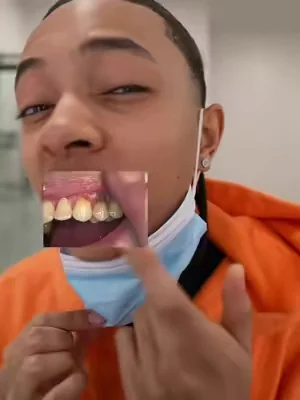 This works way too good #DealsForYouDays #hismile #yellowteeth #mouthwash #plaque 