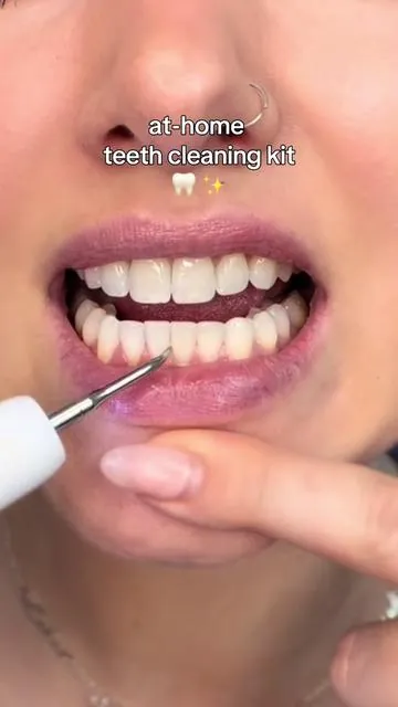 I’m not advocating you go as long as I did without going to the dentist 😬 but I am saying whatever you do, take care of your teeth! 🦷😎 This teeth cleaning kit has lowkey become a hobby 🤣🙏🏻 #dealsforyoudays #teethcare #oralcare #teethcleaning #cavities 