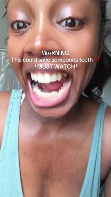 Get this shhhhh its amazing!! ✨🙌 #dealsforyoudays #tootharmour #reversecavities #dentalcare #oralhygiene 
