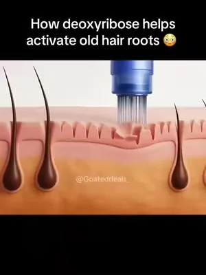 I didn’t think it would happen, but consistency won… 😳🌱‼️ #hairgrowth #hairgrowthtips #hairthinning #DealsForYouDays #summerwins 