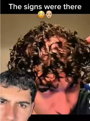 Stop ignroing your scalp!👨🏼‍🦲🧬