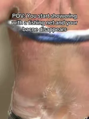POV: You start showering with a fishing net and your bacne disappears #ExfoliatingSponge #CleanTok #SatisfyingVideo #SmoothSkin #BodyScrub 
