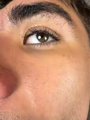 I can’t get over that brush 😩 #viral #harrys #skincare #trending #acne 