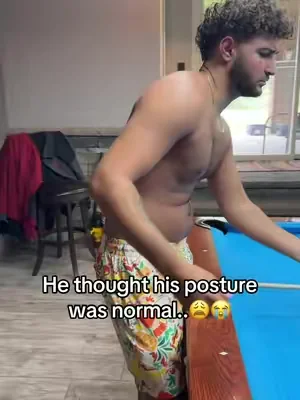 Bad posture causes BACK, NECK, & SHOULDER pain👎🏼‼️ #vkn #posturecheck #posturecorrection #DealsForYouDays #tiktokshopcreatorpicks 