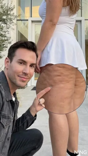 I frickn love this shit for my cellulite and stretch marks. #SummerVibes #cellulite #DealsforYouDays #SummerWins #WeeklyDeals