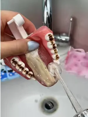 #tiktokshop #dealsforyoudays #teeth #Summer #clean 