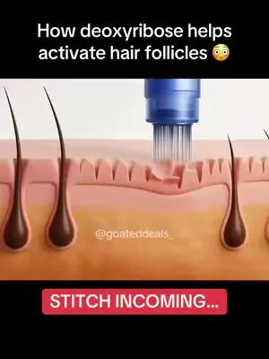 I was not expecting these results… 😳🌱‼️ #hairgrowth #hairgrowthtips #hairthinning #DealsForYouDays #summerwins 