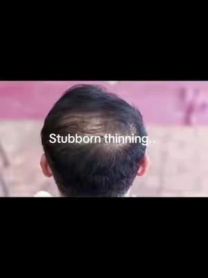 @The Ordinary Japan #tiktokmademebuyit #viral 