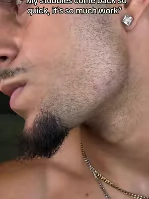 If you grow hair fast, you need one of these #dealforyoudays #Summer #menhygiene #foilshaver 