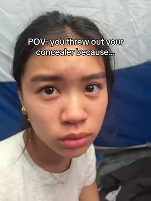 needed this so bad oh my gosh #volufiline #eyebags 