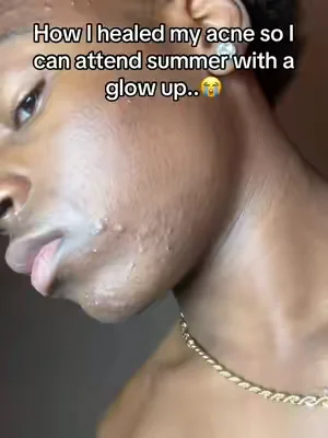 My holy grailll for my skin 