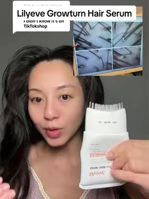 Replying to @oxxylee this  @LILYEVE GLOBAL Growturn Hair Serum was recommended by Korean scalp specialist ✨ #lilyevehairserum #hairgrowthtips #scalpcare #koreanhaircare #dealsforyoudays 