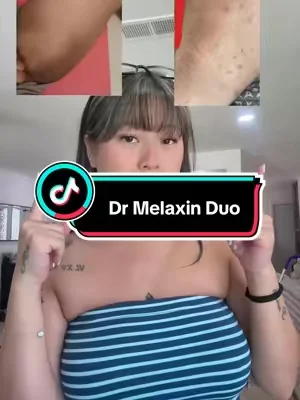 #drmelaxin #peelshotspray #kojicacid #dealsforyoudays #hyperpigmentation 