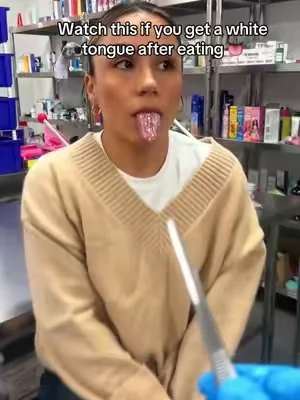 A white tongue??😭👀 #mouthwash #ad 