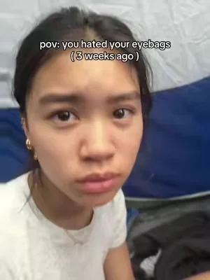 genuinly SWEAR by it #volufiline #eyebags 