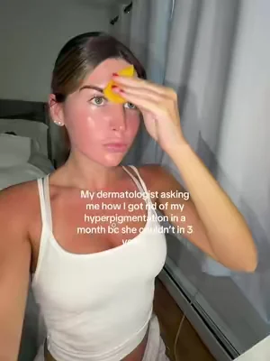 Doesn’t help that I’m a little sunburnt in this but the holy grail #creatorsearchinsights #skincareroutine #skincare #darkspots #hyperpigmentation 
