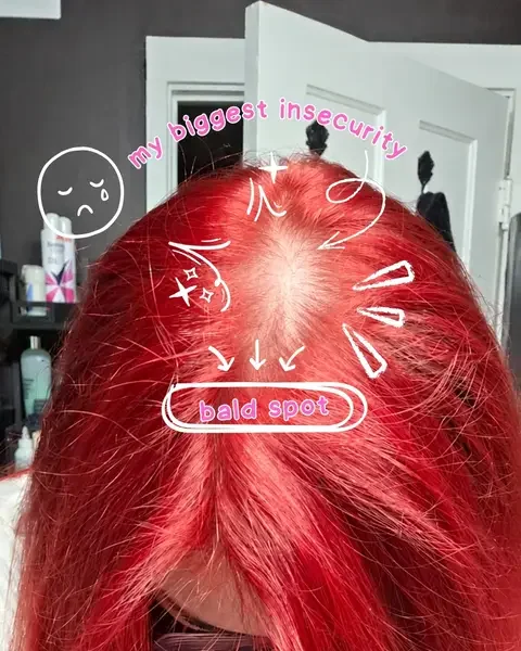 As a postpartum mom of two, I was struggling with hair loss after having both of my kids, and I thought I was going to be stuck with thin, fragile hair for the rest of my life. That is when I found this four-step hair care routine that is so easy and has really brought my hair back to life 