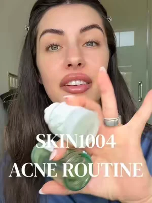 ACNE GIRLIES TO THE FRONT  @SKIN1004 US #SKIN1004 #acne #acneproneskin #acneskincareroutine #dealsforyoudays 