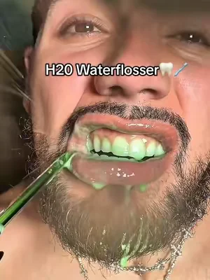 Take care of your teeth AND gums!!!🦷🪥✨#waterflosser #h2ofloss #oralhygiene #dentalcare #DealsForYouDays