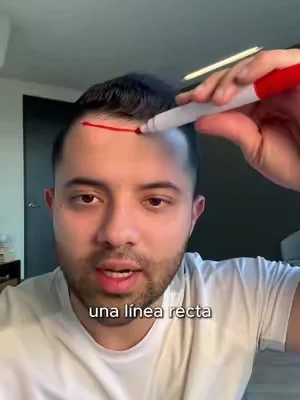 Cuando las entradas avanzan y la barba pierde uniformidad, una rutina completa puede cambiar tu imagen 💈 #hairdensity #hairdensityserum #hairdensitycare #hairlinecare #beardgrowth    