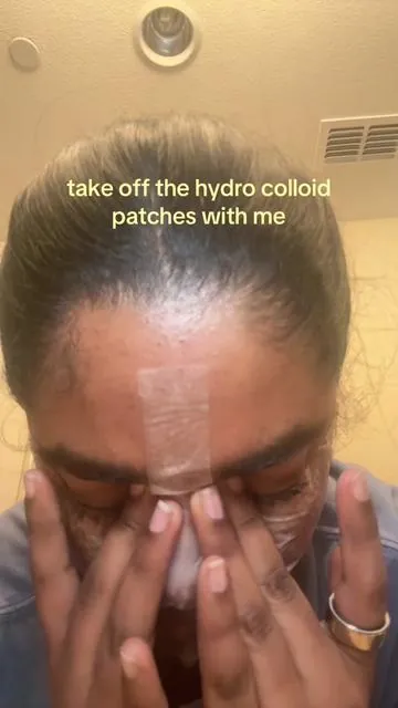 sorry my light died on me half way #hydracolloid #acnepatch #acnetreatment #pimplepatch #fyp