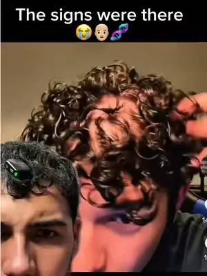 Dont be like this guy! TAKE CARE OF YOUR SCALP HEALTH👨🏼‍🦲🧬